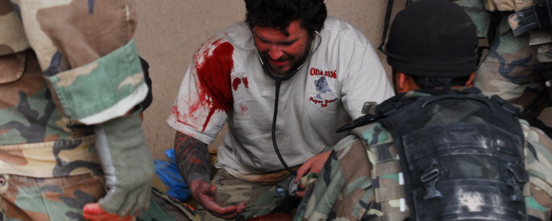 A man with blood on his face and arm.